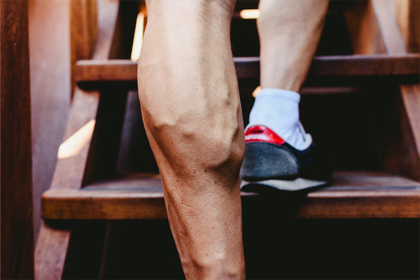 Do Men Get Varicose Veins? Yes! Here's What Causes Them